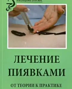 Treatment with leeches: from theory to practice: M. Vasilenko