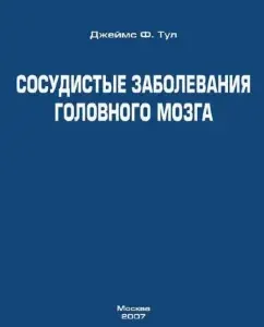 Vascular diseases of the brain. Doctors Guide: James Tool